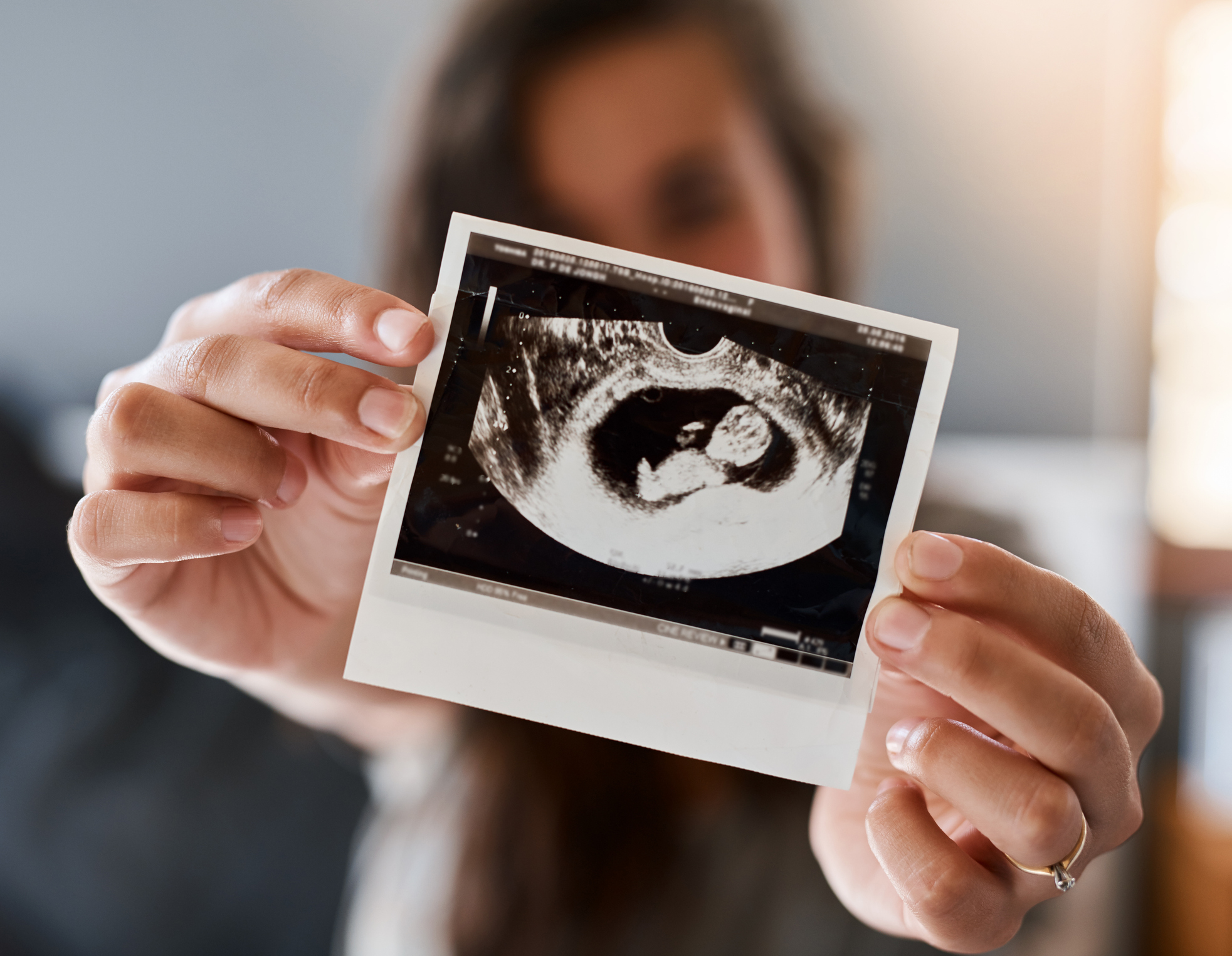 A woman holds a sonogram of her baby