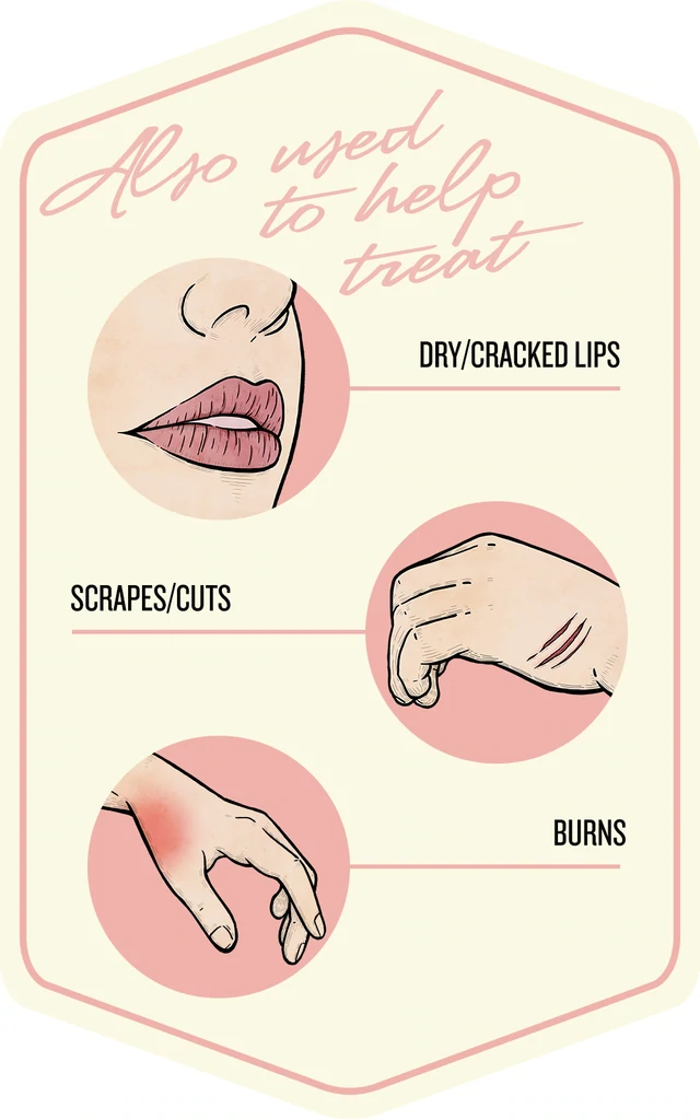 NipDip treatment uses graphic for baby and mom